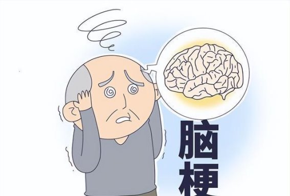 脑梗并非突然降临：细心观察早期信号，早做防范