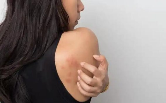 肝病早期的三大异常信号，医生提醒：不可忽视
