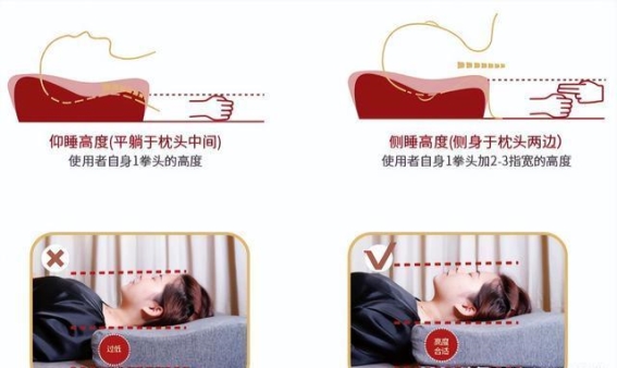交感神经型颈椎病：为何容易被误诊为焦虑症？医生揭示真相