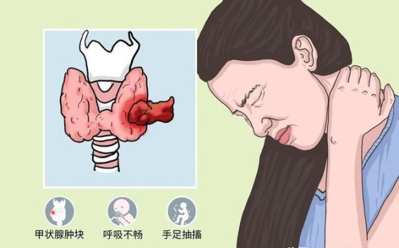 如何通过中医调理治愈甲状腺结节与脖部肿大