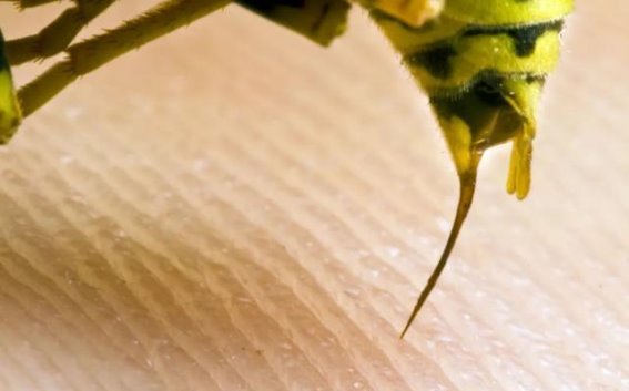 春季户外活动的潜在风险：蜜蜂蜇伤的威胁与应急对策